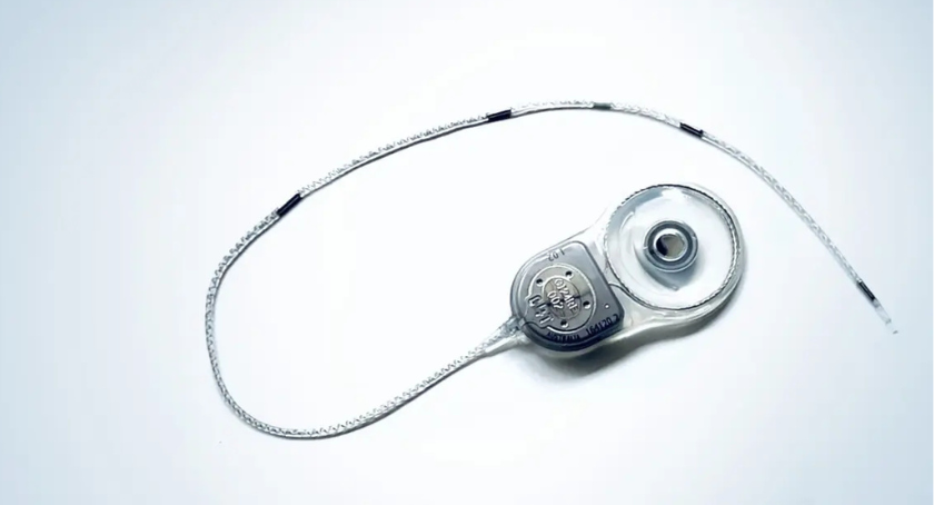 Epiminder Reports 1st Implant of Minder System in U.S.